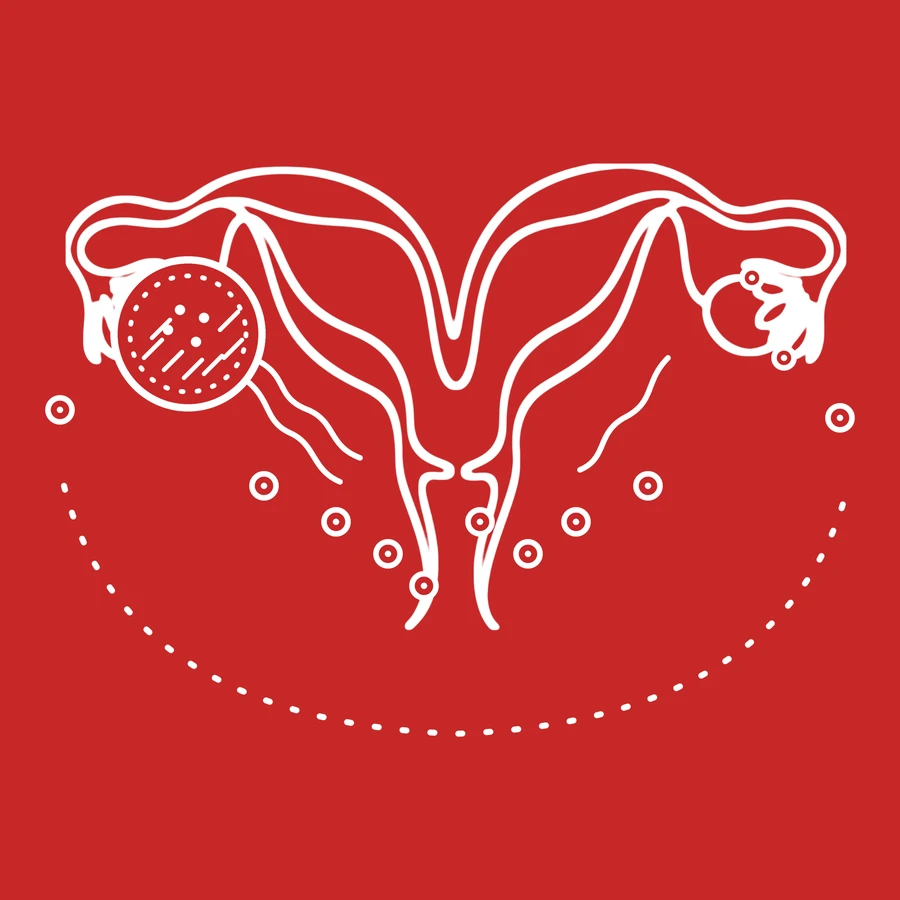 Ilustración de línea blanca sobre fondo rojo: útero, trompas y ovarios